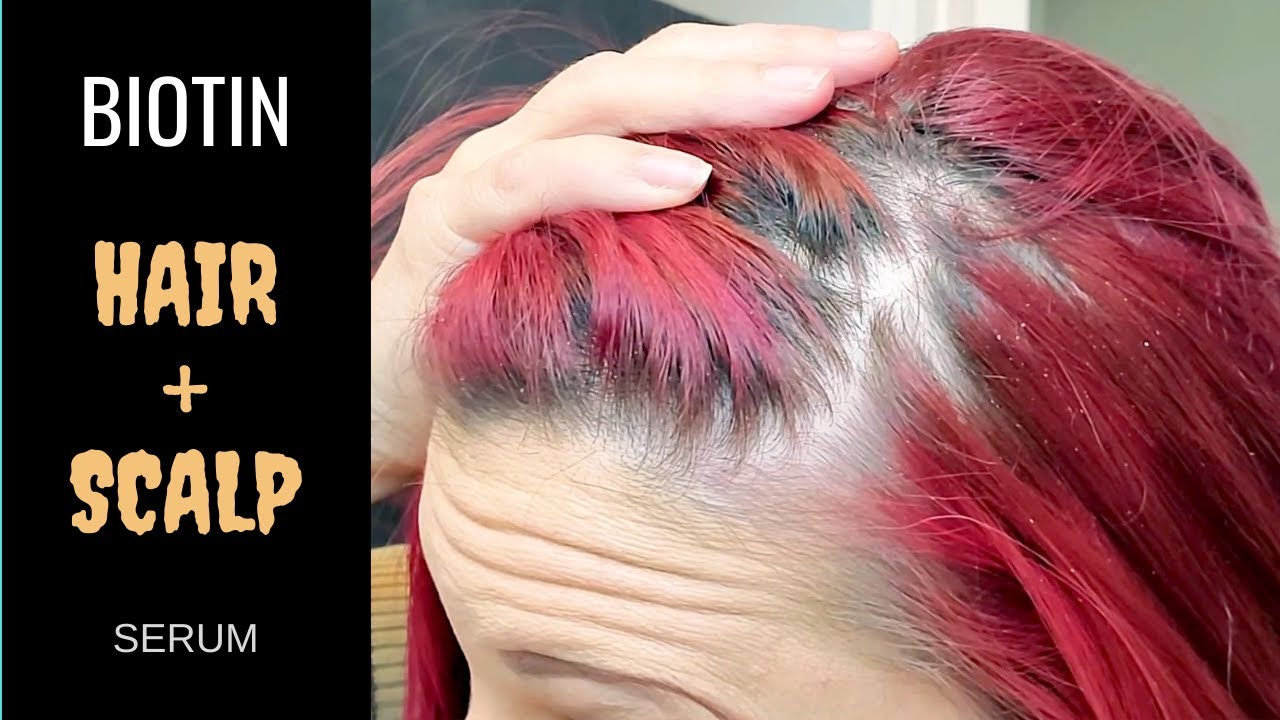 SPOILED CHILD HAIR SCALP SERUM // Does it REALLY work on thinning hair?