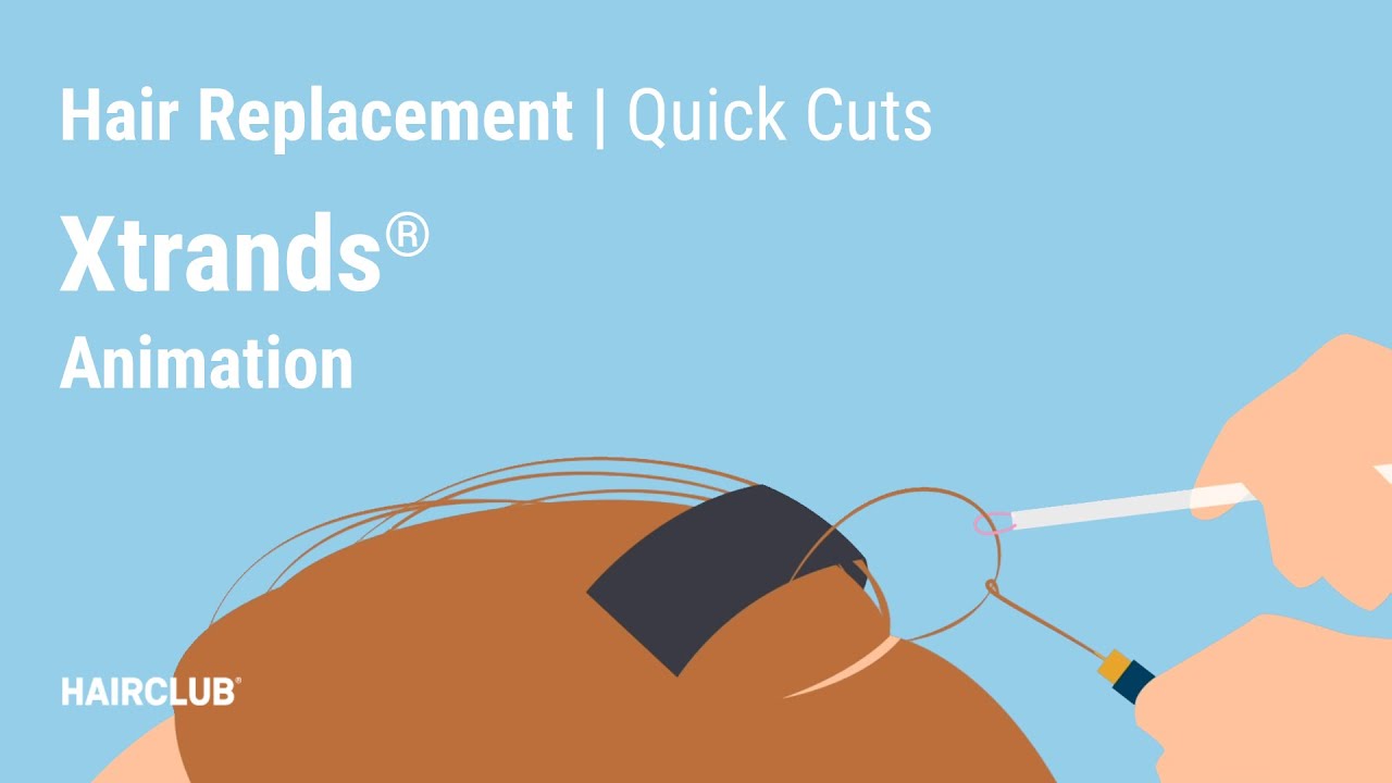 Check Out Xtrands by HairClub [Hair Loss Treatment Option]