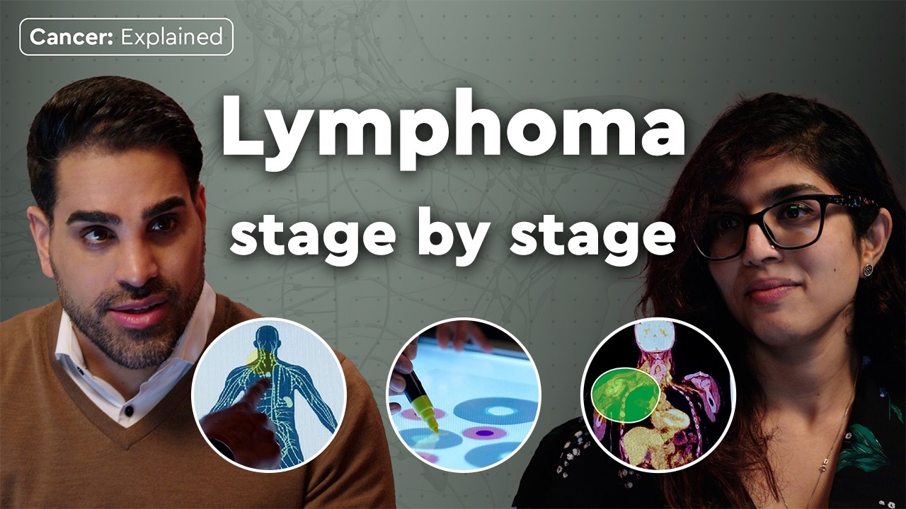 Doctors break down every stage of lymphoma | Cancer: Explained | Macmillan Cancer Support
