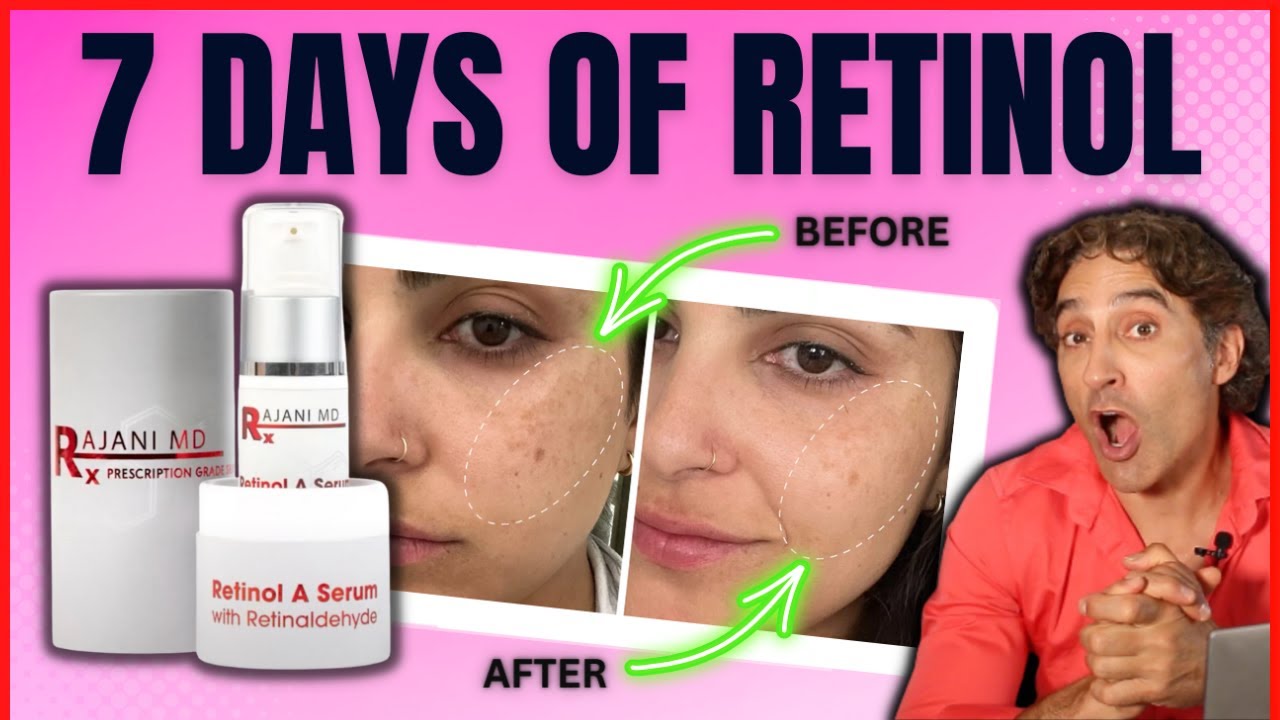 🔺RETINOL BEFORE And AFTER HALF Of HER FACE 🔺 // Retinol Serum