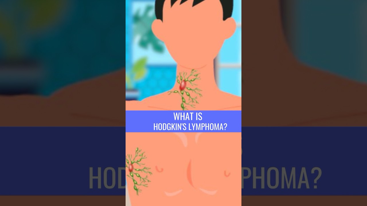 What is HODGKIN'S LYMPHOMA?