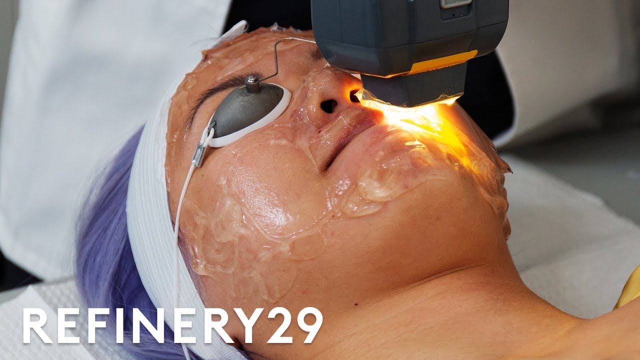 I Got The $65 Laser Facial For Acne | Beauty With Mi | Refinery29