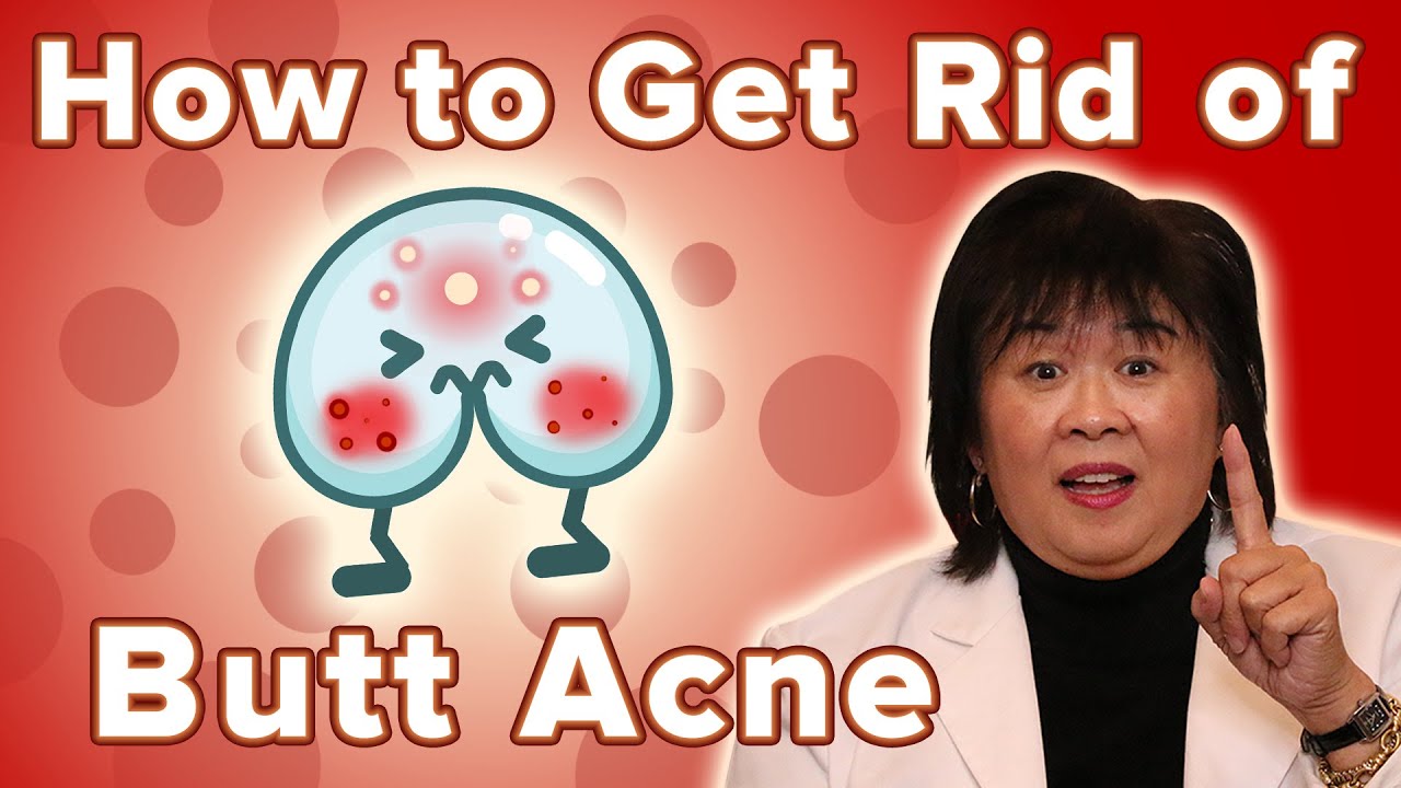 How To Get Rid Of Butt Acne