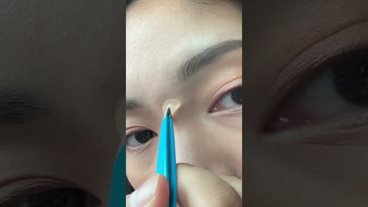 How Do Pimple Patches Work?