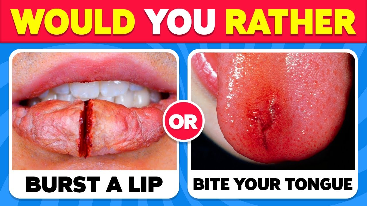 Would You Rather...? 100 HARDEST Choices Ever! 😱😨