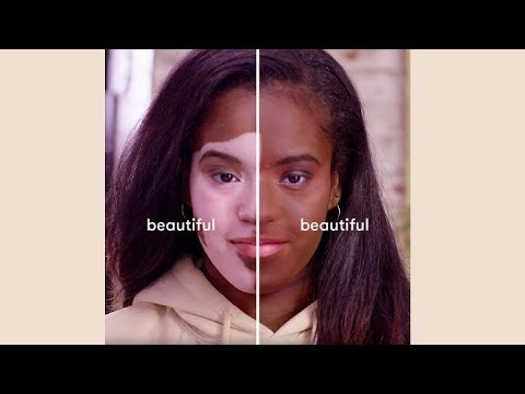 Dermablend Reflections – Foundation for Vitiligo