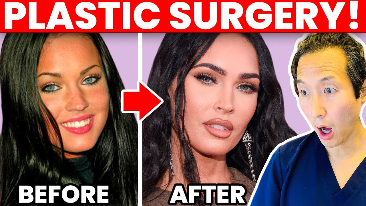 MEGAN FOX Cosmetic Surgery Transformation!