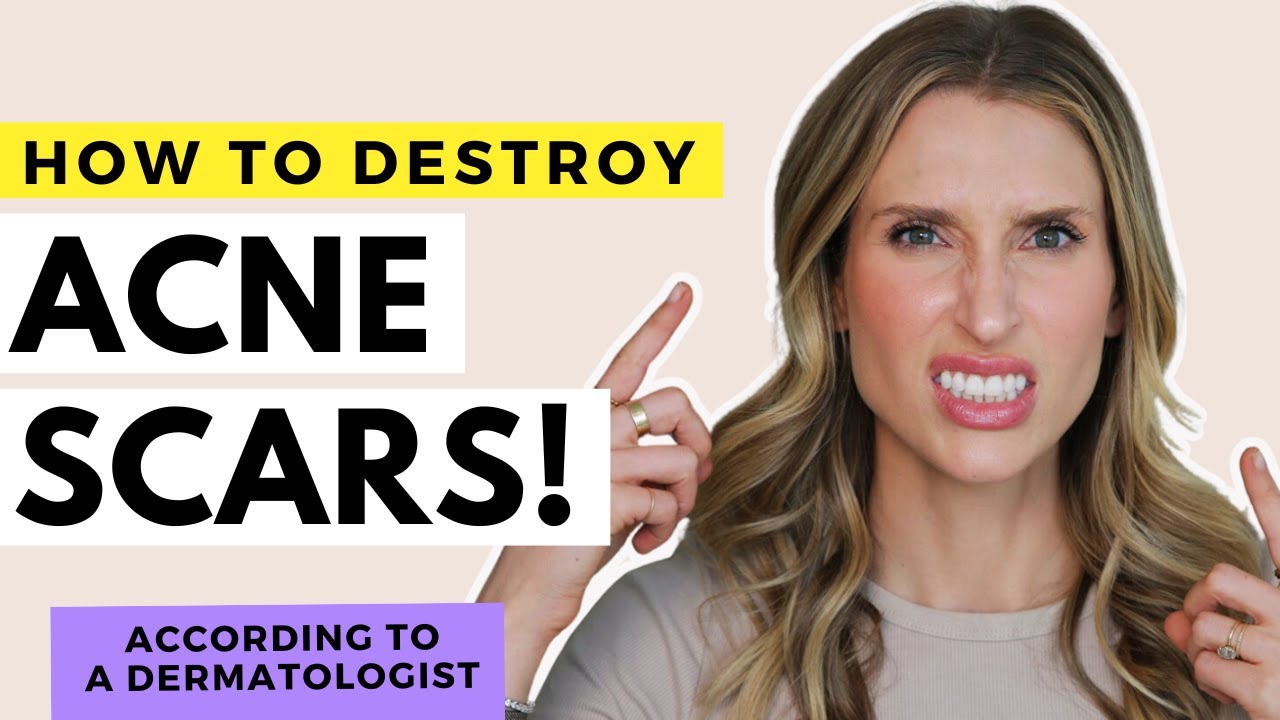 Acne Scar Treatments That Work! | Dr. Sam Ellis