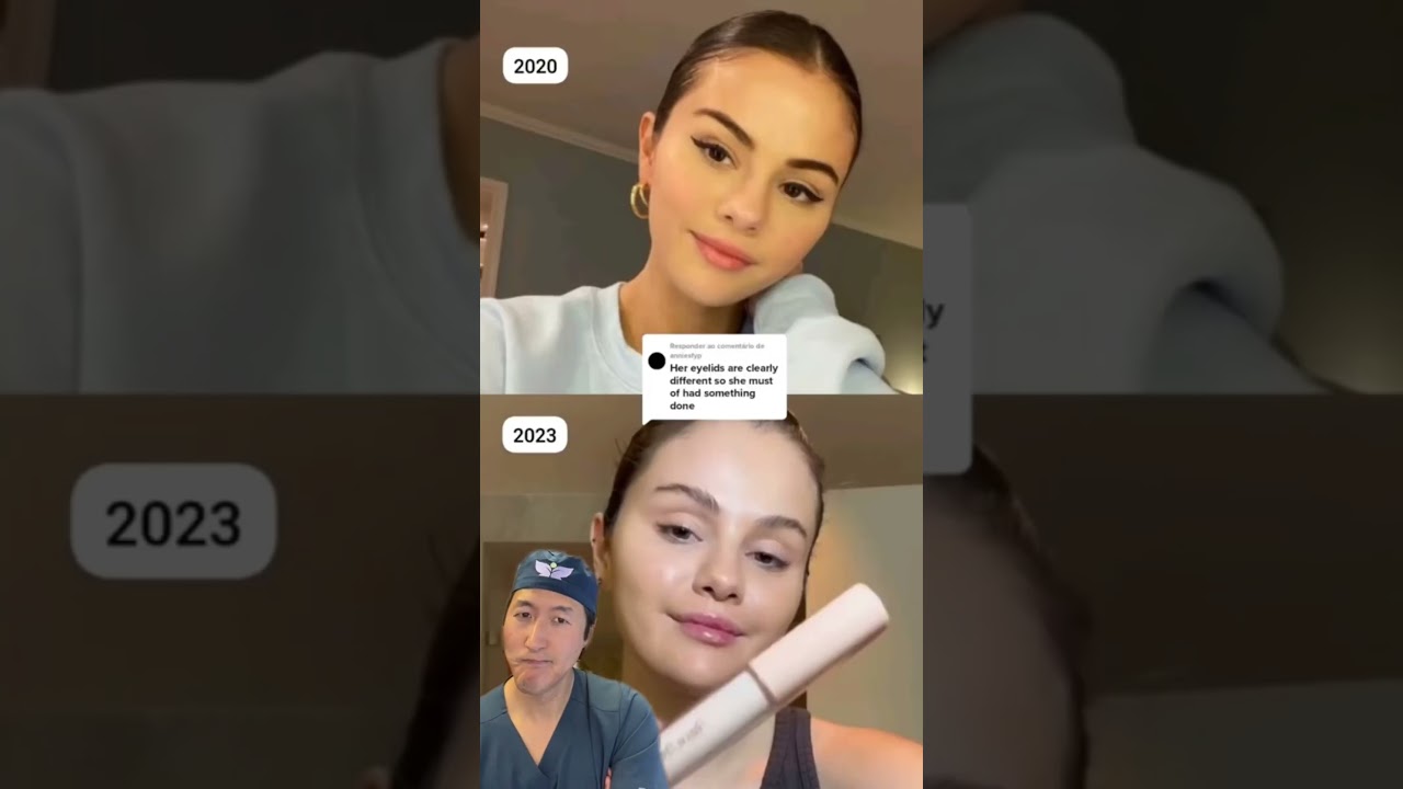 I Was Asked to Analyze Selena Gomez For Plastic Surgery #selenagomez #plasticsurgery